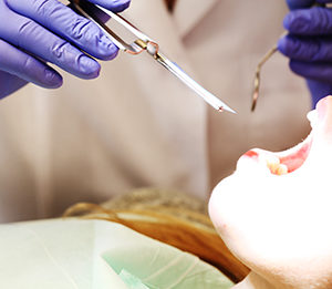 STOMATOLOGIA ZACHOWAWCZA